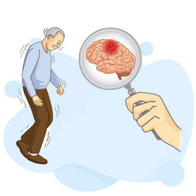 Parkinson Disease