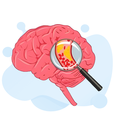 stroke assessment