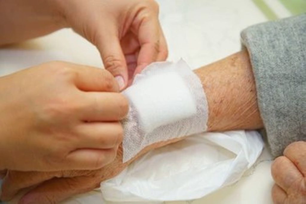 wound dressing