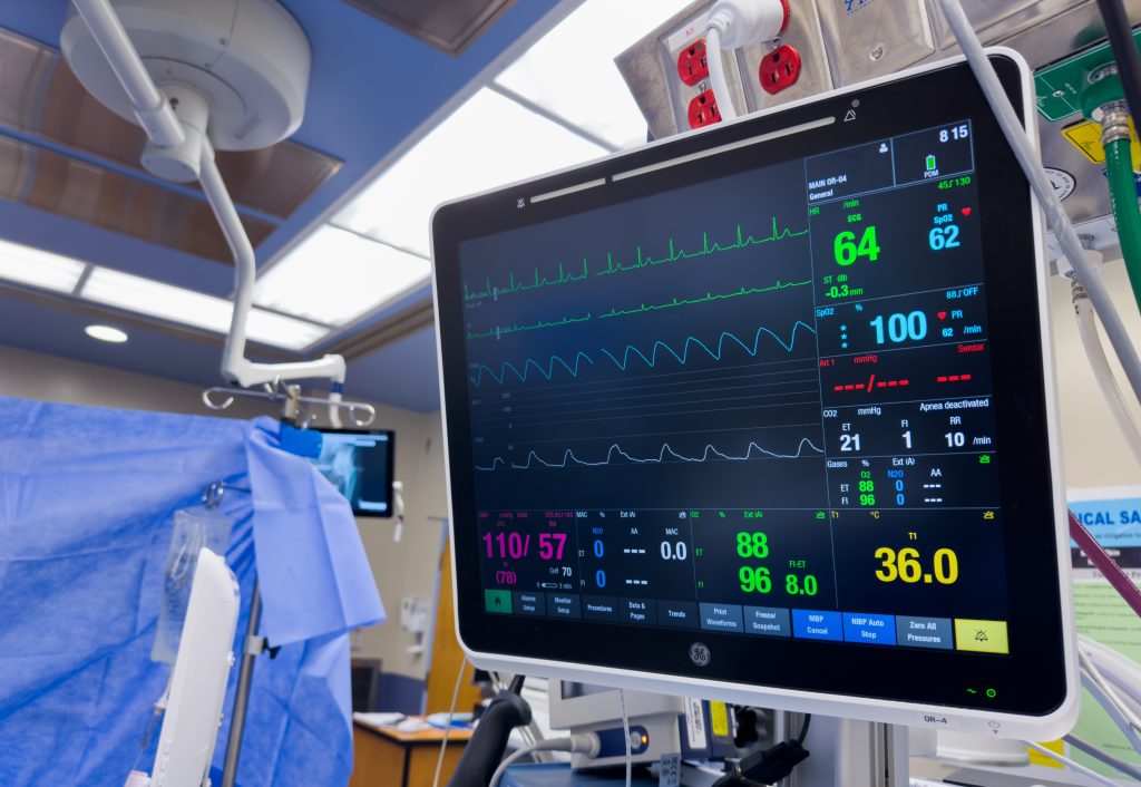 cardiac monitor